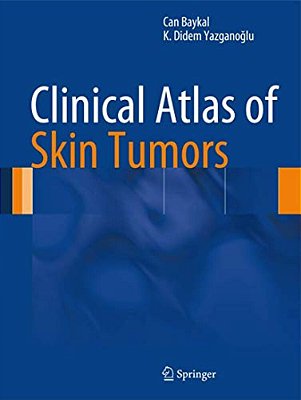 Clinical Atlas Of Skin Tumors-..