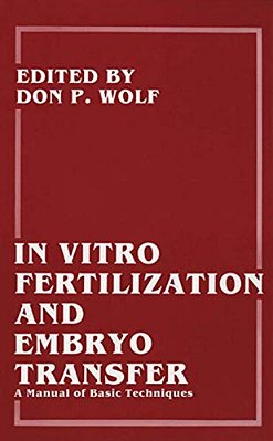 In Vitro Fertilization And Embryo Transfer: A Manual Of Basic Techniques-..