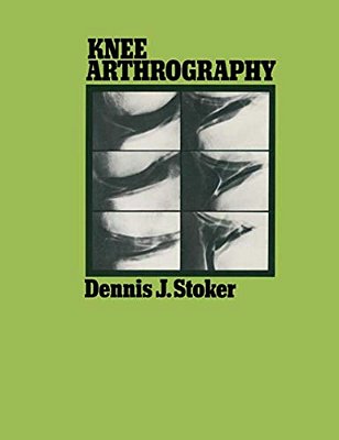 Knee Arthrography-..