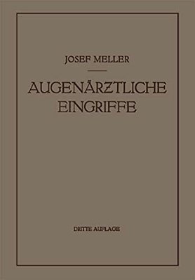 Augenärztliche Eingriffe: Ein Kurzes Handbuch Für Angehende Augenärzte-..