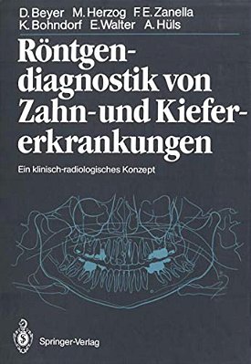 Röntgendiagnostik Von Zahn- Und Kiefererkrankungen: Ein Klinisch-Radiologisches Konzept-..