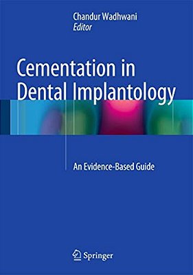 Cementation In Dental Implantology: An Evidence-Based Guide-..