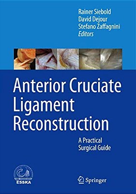 Anterior Cruciate Ligament Reconstruction: A Practical Surgical Guide-..