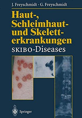 Haut-, Schleimhaut- Und Skeletterkrankungen Skibo-Diseases: Eine Dermatologische-Klinisch-radiologische Synopse-..
