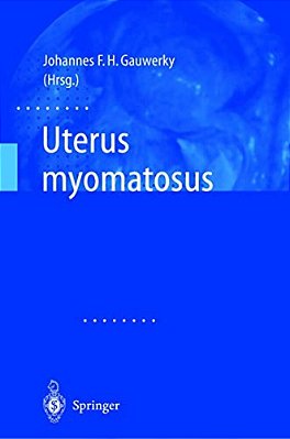 Uterus Myomatosus-..