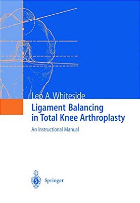 Ligament Balancing In Total Knee Arthroplasty: An Instructional Manual-..