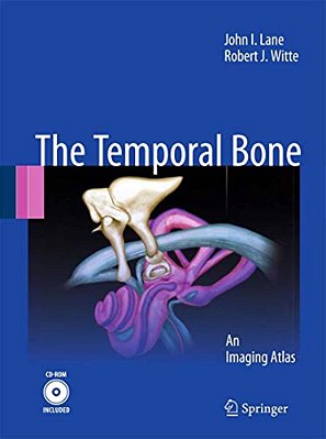 The Temporal Bone: An Imaging Atlas [With CD-ROM]-..