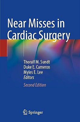 Near Misses In Cardiac Surgery-..