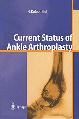 Current Status Of Ankle Arthroplasty-..