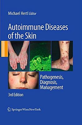 Autoimmune Diseases Of The Skin: Pathogenesis, Diagnosis, Management-..