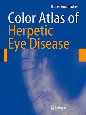Color Atlas Of Herpetic Eye Disease: A Practical Guide To Clinical Management-..
