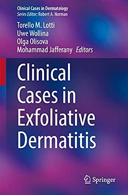 Clinical Cases In Exfoliative Dermatitis-..