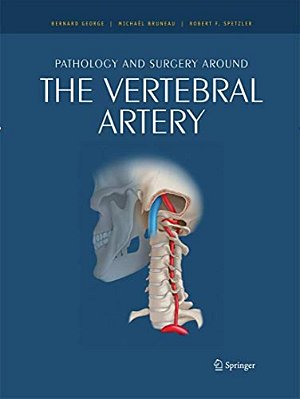 Pathology And Surgery Around The Vertebral Artery-..