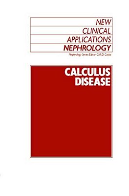 Calculus Disease-..