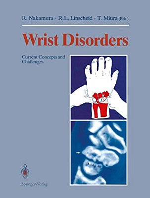 Wrist Disorders: Current Concepts And Challenges-..