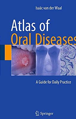 Atlas Of Oral Diseases: A Guide For Daily Practice-..