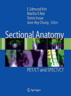 Sectional Anatomy: Pet/Ct And Spect/Ct-..