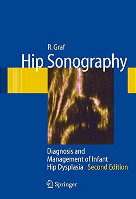 Hip Sonography: Diagnosis And Management Of Infant Hip Dysplasia-..