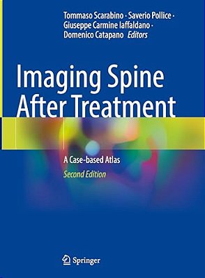 Imaging Spine After Treatment: A Case-Based Atlas-..