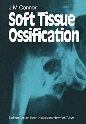 Soft Tissue Ossification-..
