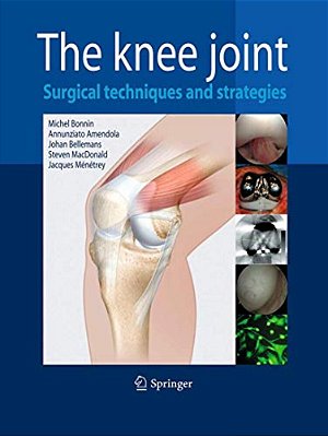 The Knee Joint: Surgical Techniques And Strategies-..