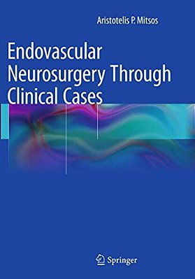 Endovascular Neurosurgery Through Clinical Cases-..