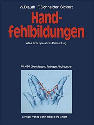 Handfehlbildungen: Atlas Ihrer Operativen Behandlung-..