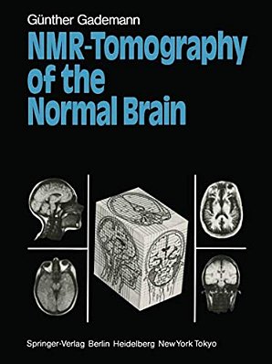 Nmr-Tomography Of The Normal Brain-..