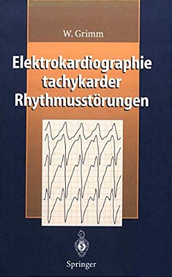 Elektrokardiographie Tachykarder Rhythmusstörungen-..