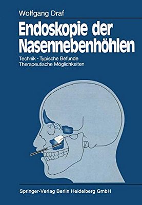 Endoskopie Der Nasennebenhöhlen: Technik - Typische Befunde, Therapeutische Möglichkeiten-..