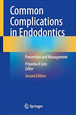 Common Complications In Endodontics: Prevention And Management-..