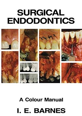 Surgical Endodontics: A Colour Manual-..