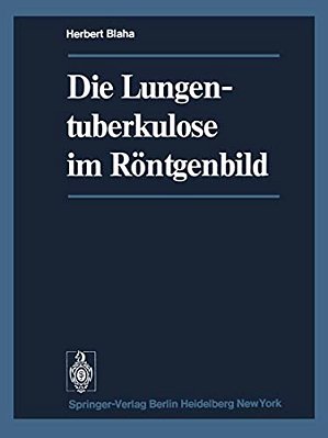 Die Lungentuberkulose Im Röntgenbild-..