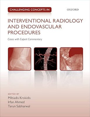 Challenging Concepts In Interventional Radiology-..