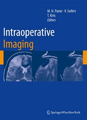 Intraoperative Imaging-..