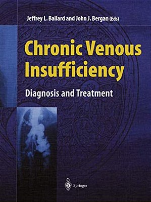 Chronic Venous Insufficiency: Diagnosis And Treatment-..
