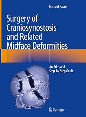 Surgery Of Craniosynostosis And Related Midface Deformities: An Atlas And Step-By-step Guide-..
