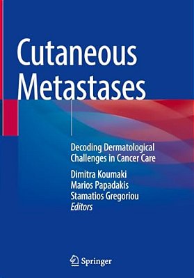 Cutaneous Metastases: Decoding Dermatological Challenges In Cancer Care-..
