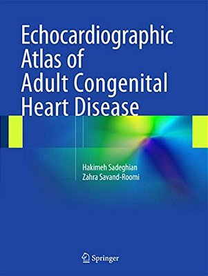 Echocardiographic Atlas Of Adult Congenital Heart Disease-..