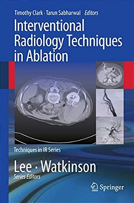 Interventional Radiology Techniques In Ablation-..