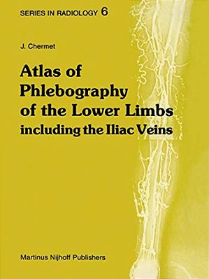 Atlas Of Phlebography Of The Lower Limbs: Including The Iliac Veins-..