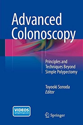 Advanced Colonoscopy: Principles And Techniques Beyond Simple Polypectomy-..