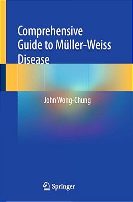 Comprehensive Guide To Müller-Weiss Disease-..