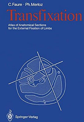 Transfixation: Atlas Of Anatomical Sections For The External Fixation Of Limbs-..