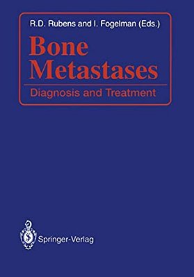 Bone Metastases: Diagnosis And Treatment-..