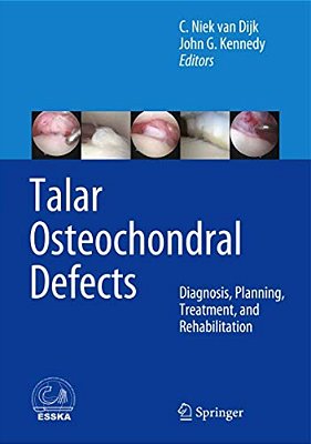 Talar Osteochondral Defects: Diagnosis, Planning, Treatment, And Rehabilitation-..