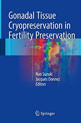 Gonadal Tissue Cryopreservation In Fertility Preservation-..