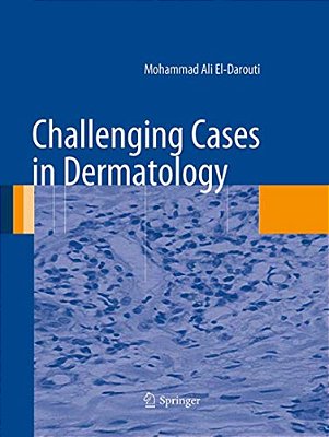 Challenging Cases In Dermatology-..