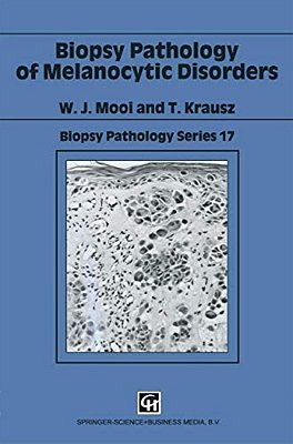 Biopsy Pathology Of Melanocytic Disorders-..