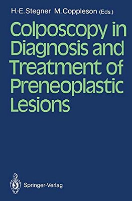 Colposcopy In Diagnosis And Treatment Of Preneoplastic Lesions-..